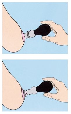 Вакуумные помпы для сосков Nipple Pump купить в sex shop Sexy